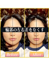 てんてんてんまてん/小顔矯正/骨盤矯正/整体/肩こり