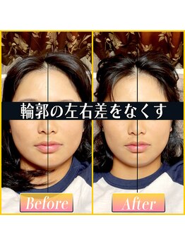 てんてんてんまてん/小顔矯正/骨盤矯正/整体/肩こり