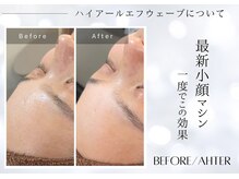 ユアーズ ビューティー(YOURS beauty)/1回で驚きの小顔へ☆