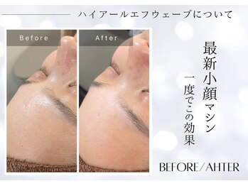 ユアーズ ビューティー(YOURS beauty)/1回で驚きの小顔へ☆