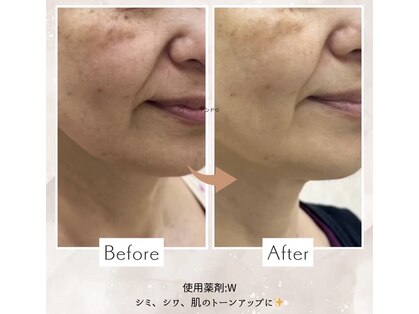 シーファイブメッドビューティ 新神戸店(C5medビューティ)の写真