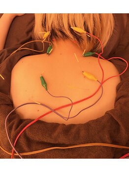 十三/電気鍼(首こり/肩こり)