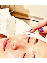 ポーラ ザ ビューティ 旭川豊岡店(POLA THE BEAUTY)/毛穴吸引/毛穴/黒ずみ毛穴/角栓