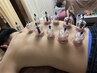 【血行促進で効果長持ち☆】炭酸整体60分＋カッピング（吸い玉）20分