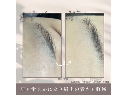 モアトゥインクル 福山宮通り店(MORE twinkle)の写真