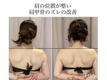 アロマオイルマッサージ＋ホームケアお伝え3回来店の効果