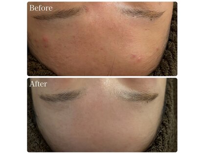 ブリエ(Briller)の写真