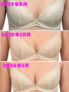 アファン 鶴見店(Afun)/バストアップBeforeAfter