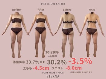 エテルナ(Eterna)/安城市　ダイエット　痩身