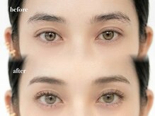 ミライ 大崎(Millieye)