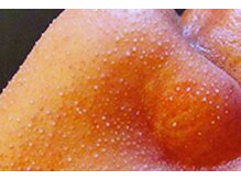 エステ デ アイリス(Esthe de Iris)の雰囲気(角栓浮き上がる・毛穴ケアリニューアル。効果3倍増し。)