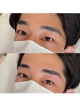 ダリ(Dali)/メンズハリウッドブロウリフト