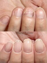 マリーロール 梅田店(Marie Laure)/自爪育成/深爪矯正/ネイルケア