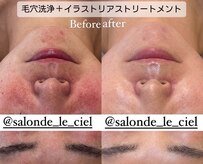 サロンドゥルシェル(salonde_le ciel)