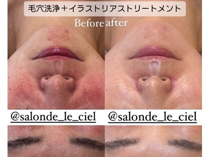 サロンドゥルシェル(salonde_le ciel)の写真