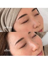 ナヴィ(NAVI)/【ララピール】水光ピーリング