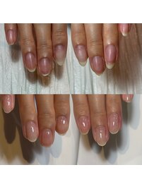 割れやすい爪の悩みも解消