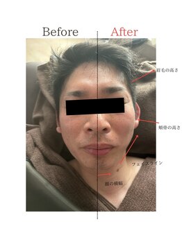 アリッチ 岡崎店(a.Rich)/オプションドライヘッドスパ15分