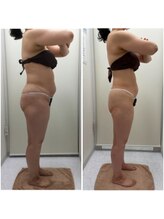 リッツ ひばりが丘パルコ店/【Before/After】痩身