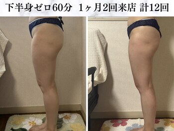 シーフェイス 横浜店(SEE FACE)/下半身ゼロダイエットモニター様