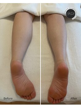 エン(YEN)/脚むくみ・歪みケア