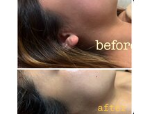 小顔/美白効果が一度で実感できます。まるで陶器のようなお肌へ