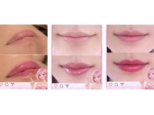 ビューティーツリー(Beauty Tree)の雰囲気（血色の悪さは【オバ化】老けて見えるマイナスポイント！）