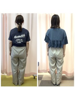 たぶし鍼灸整骨院/産後骨盤矯正