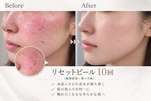 カラン(CALIN)