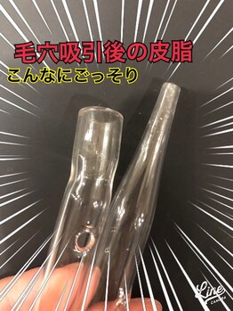 美容の宝石箱/ごっそりとれて、毛穴すっきり