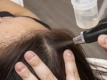 スカルプラボ 倉敷店(Scalp Lab)/炭酸ミストで頭皮洗浄