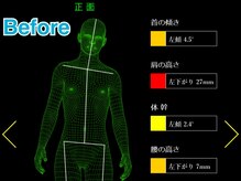 立川カイロプラクティック/矯正☆Before-After☆