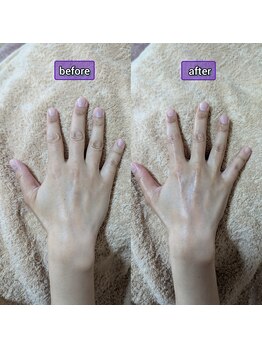 スノードロップ(snowdrop)/リンパマッサージで手が変わる♪