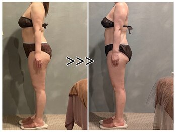 ツーアップ(2up)/前傾姿勢改善で太ももスッキリ