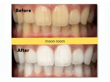ムーンルーム(moon room)