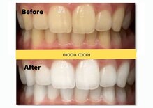 ムーンルーム(moon room)