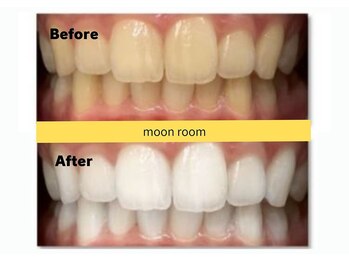 ムーンルーム(moon room)