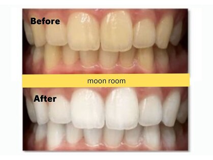 ムーンルーム(moon room)の写真