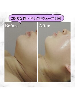 グランディールアン(GRANDIR UN)/大事な予定の前日でもOK