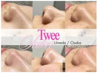 トゥウィーサロン 梅田(Tweesalon)の写真