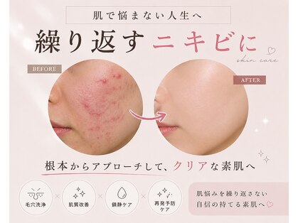 ハル(HARU.)の写真