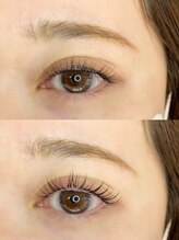 シュエット(Chouette)/アンドヘルシー100本