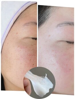 スリーエス(Three S)/フェイシャルワックス