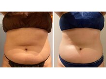 ルナグランデ(Luna grande.)/6回でこの変化♪♪