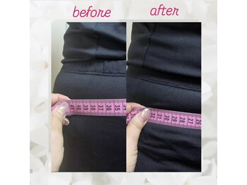 ヨサパーク エトワール 聖蹟桜ヶ丘店(YOSAPARK)/1回のLuluonnで下っ腹が-9cm!