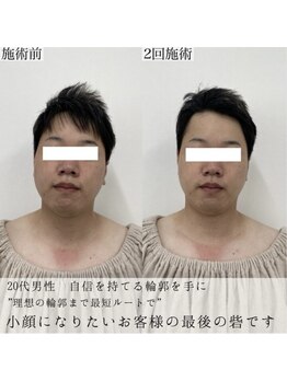 ヴェルシック(Belchic)/他店で満足できなかった方へ