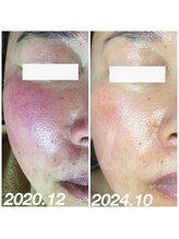 スウ(su:)/赤ら顔でお悩みの方も◎