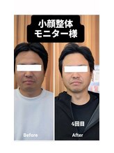 整骨院がじゅまる堂/［小顔整体］ before/after