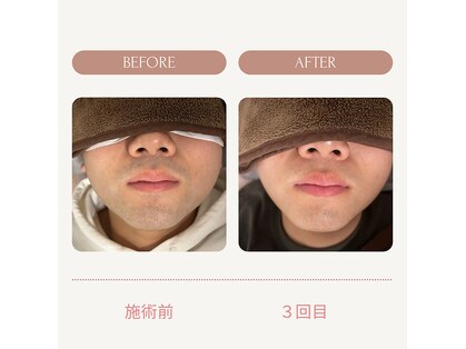 ラポール(Rapport)の写真
