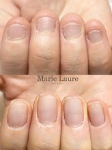 マリーロール 淀屋橋本店(Marie Laure)/深爪矯正/自爪育成/ネイルケア